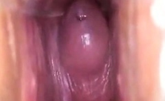 Girl's Tiring Doctor Visit: A Webcam Capture